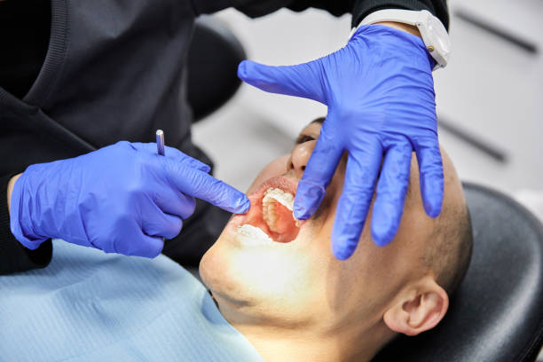 Best Emergency Broken Tooth Repair in Glen Alpine, NC