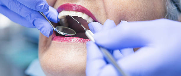 Best Emergency Tooth Extraction in Glen Alpine, NC