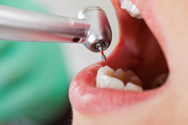 Best Emergency Treatment for Toothache in Glen Alpine, NC